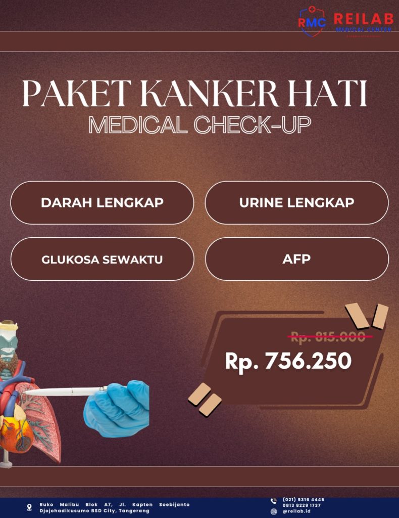 19. Paket Medical Check Up Kanker Hati